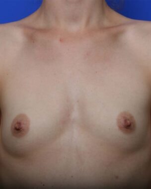 Case # 5 before photo