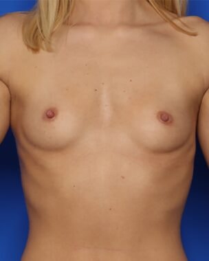 Case # 6 before photo