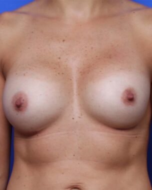 Case # 11 after photo