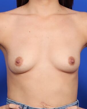 Case # 16 before photo