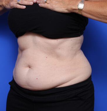 Case # 6 before photo