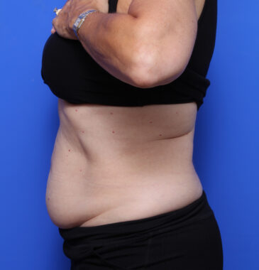 Case # 6 before photo