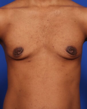 Case # 22 before photo