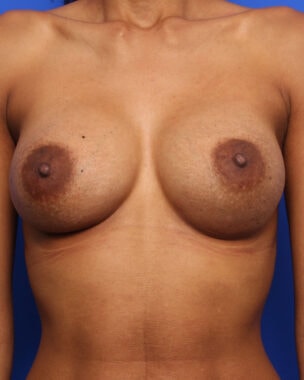 Case # 24 after photo