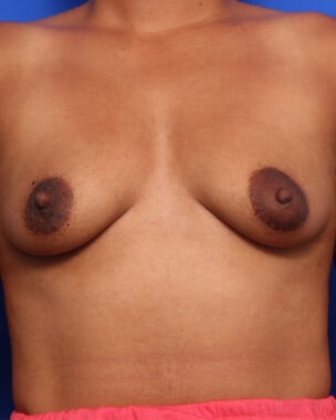 Case # 27 before photo