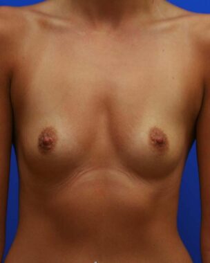 Case # 9 before photo