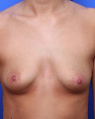 Case # 10 before photo