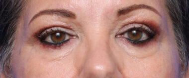 Case # 2 after photo