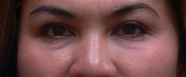 Case # 9 after photo