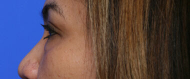 Case # 9 before photo