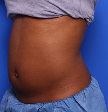 Case # 12 before photo