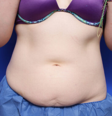 Case # 19 before photo