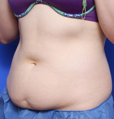 Case # 19 before photo