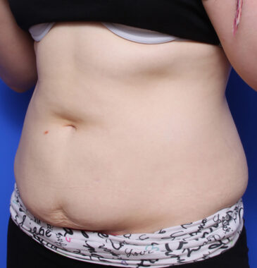 Case # 19 after photo