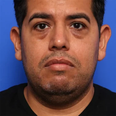 Case # 1 before photo