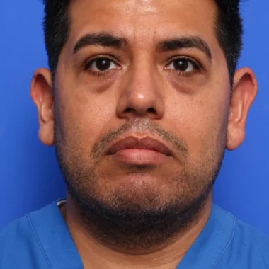 Case # 1 after photo