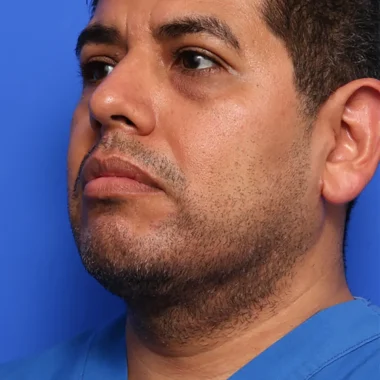 Case # 1 after photo