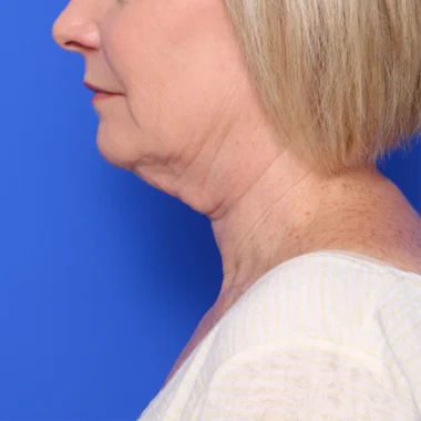 Case # 2 before photo