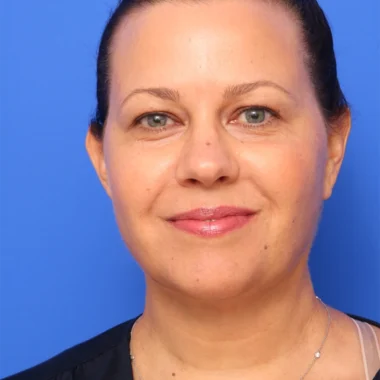 Case # 4 after photo