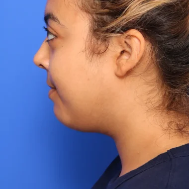 Case # 5 before photo