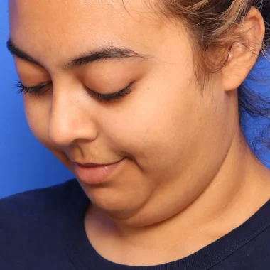 Case # 5 before photo