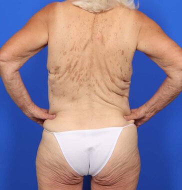 Case # 4 before photo