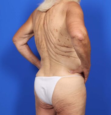 Case # 4 before photo