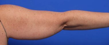 Case # 8 before photo