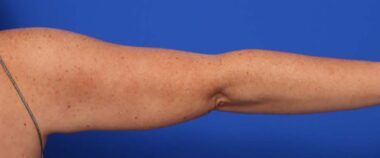 Case # 8 after photo