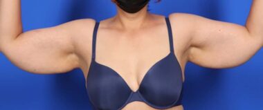 Case # 12 before photo