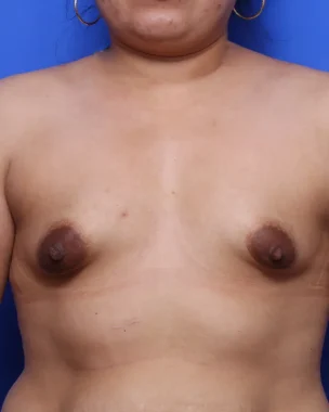 Case # 3 before photo