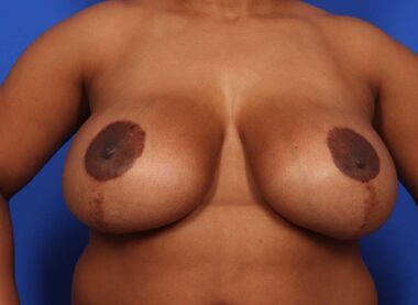 Case # 12 before photo