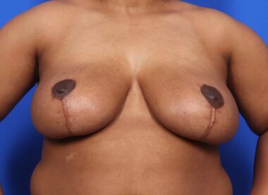 Case # 12 after photo