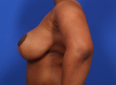 Case # 12 before photo