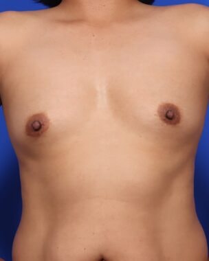 Case # 28 before photo