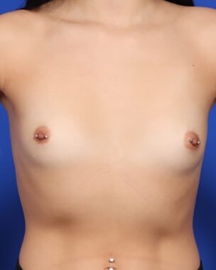 Case # 34 before photo