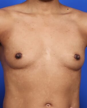 Case # 36 before photo