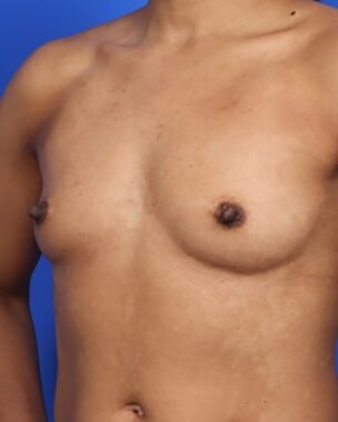 Case # 36 before photo