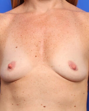 Case # 37 before photo