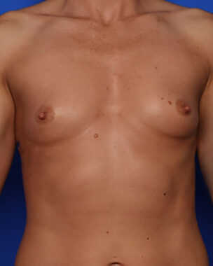 Case # 39 before photo