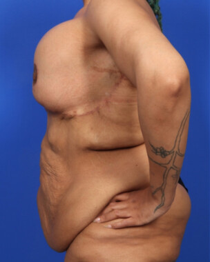 Case # 1 before photo