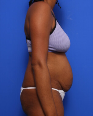 Case # 58 before photo