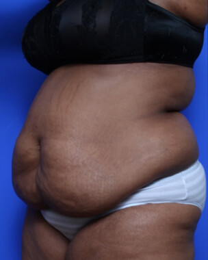 Case # 59 before photo