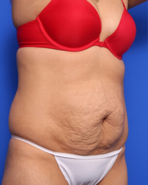 Case # 60 before photo