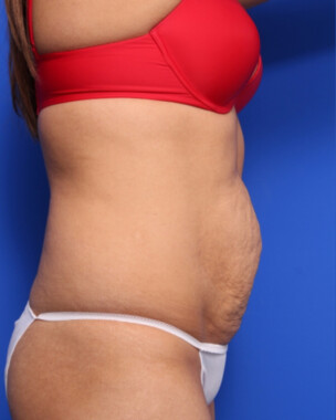 Case # 60 before photo