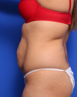 Case # 60 before photo