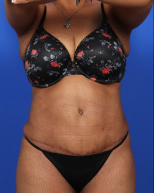 Case # 61 after photo