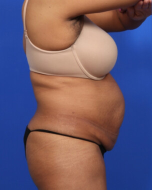 Case # 61 before photo