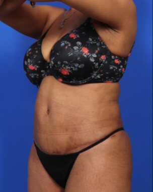 Case # 61 after photo