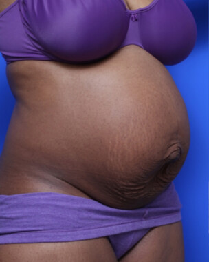 Case # 62 before photo